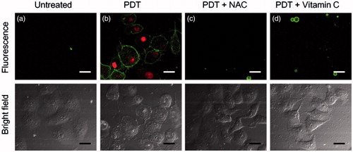 Figure 7. Confocal fluorescence images of Annexin V-FITC/PI stained HeLa cells with different treatments: (a) the capsule-loaded HeLa cells were incubated without (b) or with NAC (c) or vitamin C (d) followed by irradiation with 20 J cm−2 638 nm laser. Untreated HeLa cells set as control. Scale bars are 30 μm.
