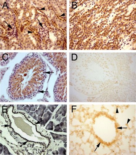 Figure 2.  Immunohistochemical staining for PHPT1. A: A section of adult mouse kidney shows PHPT1 expression in the distal convoluted tubules (arrowhead) but not in the glomeruli (arrow) and a weak expression in the proximal convoluted tubule. B: PHPT1 is expressed in the Henle's loops of adult kidney. C and D: Sections of seminiferous tubule of adult mouse testis. Arrows in C point to the spermatogonium of seminiferous tubule. D: An absorption test shows that PHPT1 signals were abolished in the mouse testis. E: PHPT1 is expressed in the epithelium of interlobular duct of pancreas (arrow). F: PHPT1 is expressed in the epithelium of bronchiole (arrow). Arrowheads point at macrophages in alveoli. Amplifications were 400× for A–F.