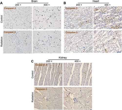 Figure 5. Effect of mobile phone radiation on cell apoptosis. Representative results of cleaved caspase-3 staining in rabbit tissues. Radiation, exposure to mobile phone radiation. Control, sham exposure to mobile phone radiation. 200× and 400×, magnifications. (A) Brain (B) Kidney (C) Heart.