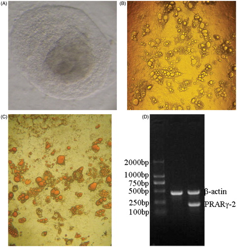 Figure 1. Differentiation of human embryonic stem cells (hESCs) into adipocytes and the identification of adipocytes. (A) Thawed clones before passage ×100. The thawed hESCs are incubated in an inactivated mixed feeder layer (1:1 of mouse embryonic fibroblasts: human foreskin fibroblasts) at 37°C in an atmosphere of 5% CO2 for two days. Next day, hESCs are observed under an inverted microscope. hESCs grow in colony, and are flat in shape with clear cell boundaries. (B) Adipocytes induced for 21 days ×40. Three days after induction, clones become loose with irregular edge. Five days after induction, lipid droplets are seen in cytoplasm with the nucelus in cellular center. Two weeks after induction, mature adipocytes occur. More and more lipid droplets gather, and then cells become round or oval in shape and the nucelus are pulled to one side of the cells. Differentiation peak occurs 21 after induction. (C) Oil red O staining ×40. After hESCs differentiate into mature adipocytes, cells become round with strong refractivity and lipid droplets gather. Lipid droplets in mature adipocytes can be specifically stained with oil red O, showing red color. (D) peroxisome proliferator-activated receptor gamma (PPARγ)2 mRNA expression detected by RT-PCR RNA in cells is extracted with Trizol, and then PPARγ2 mRNA expression is detected with β-actin mRNA as internal control. Lane 1 displays that there is no PPARγ2 expression in the pre-differentiated hESCs. Lane 2 displays that there is PPARγ2 expression in the differentiated adipocytes.