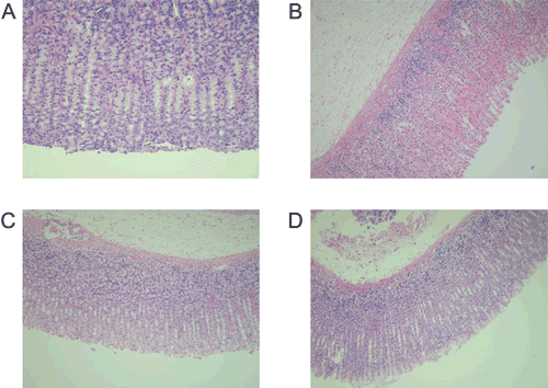 Figure 1.  Light micrographs showing the effect of celery extract on ethanol- induced gastric lesions of rats. A: Normal mucosa; B: Ethanol-induced gastric mucosal congestion and necrosis; C: Pretreatment of rats with celery extract 250 mg/kg; D: Pretreatment of rats with celery extract 500 mg/kg.