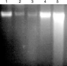 Figure 5.  Agarose gel electrophoresis of DNA fragments in mouse liver. DNA was isolated and assessed by agarose gel electrophoresis containing ethidiumbromide. 1-control; 2- FLD1 + B(a)P; 3-FLD2 + B(a)P; 4-onlyFLD2; 5-onlyB(a)P.
