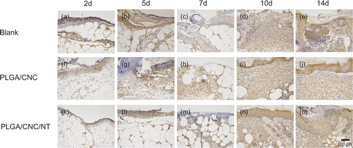 Figure 6. The expression of IL1β in dorsal skin after full-thickness wounds in diabetic mice. The bar corresponds to 100 μm.