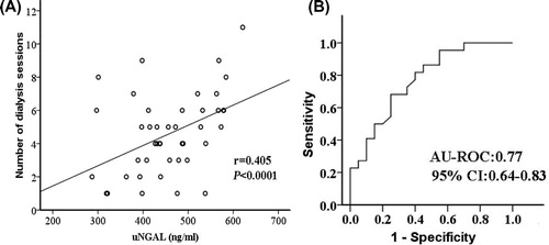 Figure 3. Peak uNGAL associated with hemodialysis. Peak uNGAL correlated with the number of hemodialysis sessions each patient received during hospitalization (A). Shown are ROC curves for peak uNGAL in predicting the need of hemodialysis (B).