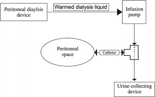 Figure 2.  Manual PD technique (connection and liquid flow direction; set dwell volume and infusion time with infusion pump which takes warmed dialysis liquid from PD device. Pumping route is through into peritoneal space. Control filling and drainage with three-way router. While filling phase, close drainage side of the router. When filling phase is done, three-way router is setted completely closed for dwelling. After that, open drainage side for flowing out. Drained liquid is collected with urine-collecting device to measure ultrafiltration).