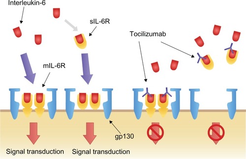 Figure 2 Interleukin-6 signal transduction and blockage by tocilizumab.Reprinted from Biologics, volume 2, Okuda Y, Review of tocilizumab in the treatment of rheumatoid arthritis, pages 75–82, Copyright © 2008, with permission from Dove.Citation26