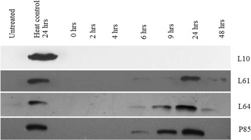 Figure 4. Inhibition of Hsp70 expression in DHD/K12/TRb cells treated with different Pluronics and 43°C low-grade hyperthermia for 20 min. Western blots reveal that the Hsp70 expression was totally diminished by L10 + heat treatment. Pluronic L61, L64, and P85 + heat treatment down-regulate Hsp70 for 6 h.