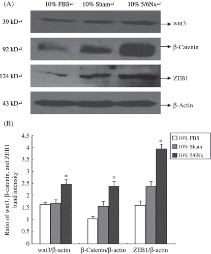 Figure 8. Expression of wnt3, β-catenin, and ZEB1 in HK-2 cells. (A) Western blot analysis of wnt3, β-catenin, and ZEB1. Lanes 1–3 are 10% FBS group, 10% sham operation serum group, and 10% 5/6 nephrectomized rat serum group, respectively. (B) wnt3, β-catenin, and ZEB1 protein levels. Data were expressed versus β-actin and compared with ANOVA.Notes: The experiment was repeated three times with similar results.*Denotes p < 0.05 versus 10% sham operation serum group.