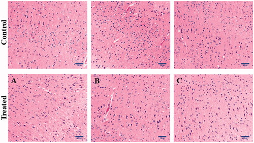 Figure 7. Histopathological examination of normal brain tissues treated with Cm-Au-PLGA-PSPE nanocomposites. (A) treated at 10 μgmL−1 (B) treated at 50 μgmL−1 and (C) treated at 100 μgmL−1.