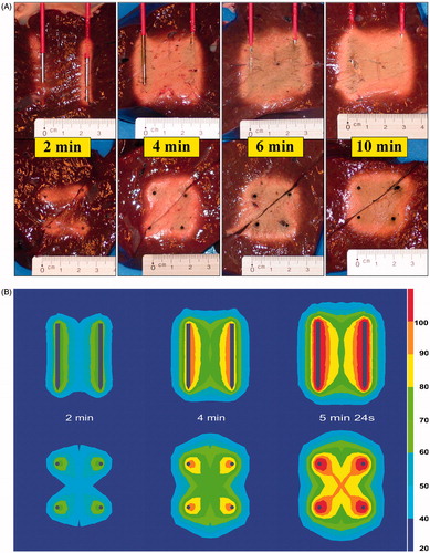 Figure 5. (A) Ex vivo bovine liver experiments: influence of duration on ablation zone in axial and transverse plane (50 W). (B) FEM modelling with RAFEM-2: influence of duration on temperature distribution in axial and transverse plane (50 W). There are no results for 6 and 10 min because power shut-off in the simulation occurred at 5 min 24 s.