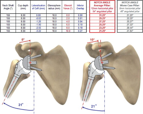 Figure 6. Influence of downward glenoid inclination on the notch angle (called “glenoid varus” in the spreadsheet). (Simulation of maximal adduction in average scapular morphology and in worse-case scapular anatomy: no horizontal pillar. Images of average scapular morphology).