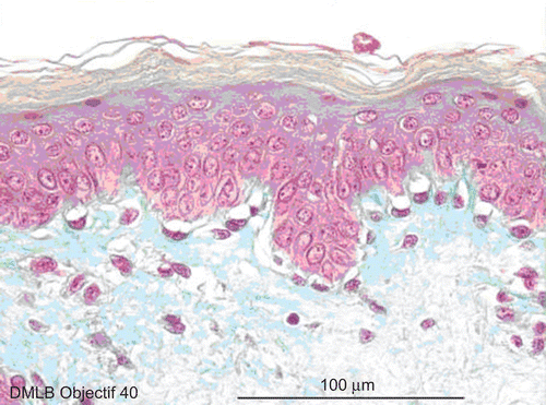 Figure 4.  Skin histological aspect at 1 min after a 20-sec exposure to 30 µL of 70% hydrofluoric acid (HF). The epidermis showed four to five cellular layers with a slightly modified morphology. The cells showed gray cytoplasm in the upper layer and the nuclei became pyknotic. The cellular structures of the basal epidermis and throughout the dermis showed normal morphologies.