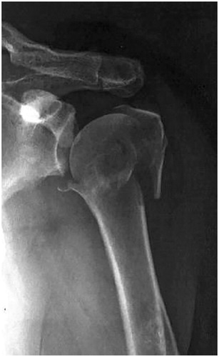 Figure 1. The radiograph shown in the survey; the same for all 5 patient descriptions.