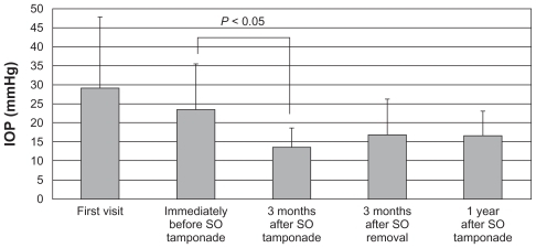 Figure 1 The time course of IOP changes. At the first visit, immediately before and 3 months after PPV + PPL + E PC + S O tamponade, 3 months after SO removal + I OL, and 1 year after PPV + PPL + EPC + SO tamponade, the IOPs (mean ± SD) were 29 ± 19, 23 ± 12, 13 ± 5, 17 ± 10, and 17 ± 6 mmHg.