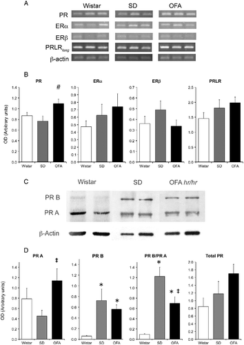 Figure 5.  Hypothalamic prolactin (long form, PRLRlong), estradiol (ER), and progesterone (PR) receptor mRNA abundance by RT PCR and progesterone receptor protein by Western blot at the end of pregnancy in OFA, SD, and Wistar rats. Panel A: representative photograph of RT-PCR products run in 1.5% agarose gel of three samples of each strain of rats. Panel B: semiquantitative PCR analysis of total PR, ERα, ERβ, and PRLRlong mRNA abundance relative to β-actin in mediobasal hypothalamus (MBH). Panel C: representative immunoblots of hypothalamic PR isoforms and β-actin in the three rat strains. Panel D: expression relative to β-actin of PR isoforms A and B, PR isoform ratio, and total PR. Data are mean ± SEM; n = 8 rats of each strain. #P < 0.05 vs. Wistar and SD rats, *P < 0.05 vs. Wistar rats, ‡P < 0.05 vs. SD rats; two-way ANOVA and τ-test.
