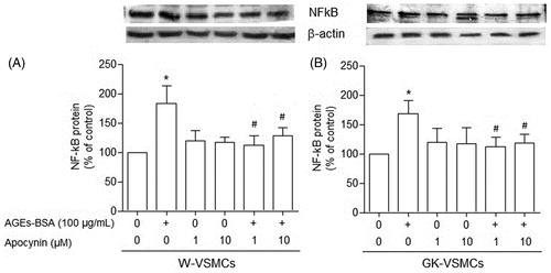 Figure 2. NF-κB expression in vascular smooth muscle cells (VSMCs) from non-diabetic (W) rats (panel A) and Goto–Kakisaki (GK) rats (panel B) stimulated by AGEs-BSA in the presence or absence of apocynin. The influence of AGEs-BSA (100 μg/mL) on NF-κB expression, expressed as percentage in relation to control, in the presence of apocynin (1 and 10 µM) was investigated by Western blot analysis. Values represent the NF-κB/β-actin ratio. Data are shown as mean ± SEM of three independent experiments per group, each performed in quadruplicate. *p < 0.05 versus bar one (one-way ANOVA followed by Bonferroni's test), #p < 0.05 versus bar two (one-way ANOVA followed by Bonferroni's test).