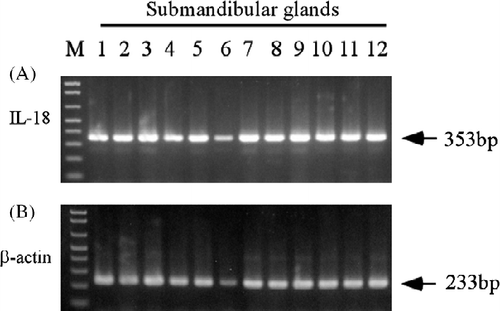 Figure 2.  IL-18 expression in pig salivary glands (n = 12 submandibular glands) by RT-PCR. Total RNA was isolated from the salivary glands, and the RT-PCR analyses for porcine IL-18 and β-actin were performed as described in the Materials and methods. Each PCR product size is shown at the right. M: 100 base ladder marker.