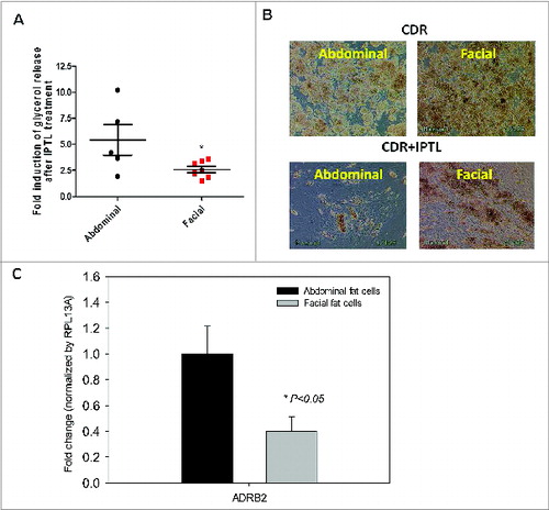 Figure 4. β-adrenergic receptor expression and responsiveness to isoproterenol in differentiated facial and abdominal preadipocytes. On day 14, cultures remained untreated (CDR) or were incubated with 10 μM isoproterenol (CDR+ IPTL) for up to one week. (A) Acute glycerol release after 5 hour isoproterenol treatment (2 μM). Data represented as mean ± SEM. Abdominal cells, n = 5 donors and facial cells, n = 7 donors. *Student t test P < 0.05. (B) Representative image of facial and abdominal adipocytes before and after 1 week of isoproterenol exposure. (C) After 1 week of isoproterenol treatment, the expression of lipid metabolic genes was evaluated by qPCR analysis and was normalized by expression of the RPL13A gene. Abdominal cells, n = 6 donors and facial cells, n = 4 donors. CD, control differentiation; CDR, CD + 10 μM rosiglitazone; ADRB2, β2-adrenergic receptor. Passages 2 until 6 were used for abdominal cells and passages 3 untill 11 were used for facial cells.