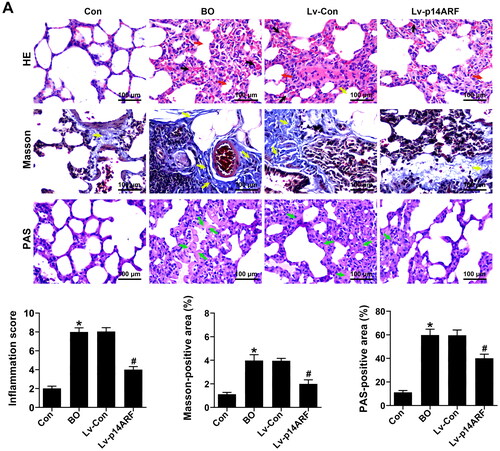 Figure 3. p14ARF ameliorated the pathological morphology of lung tissue in BO mice. On the 28th day, 10 mice in each group (Con group, BO group, Lv-Con group, and Lv-p14ARF group) were sacrificed, and HE staining (Black arrows indicated inflammatory cell infiltration, and red arrows indicated alveolar atrophy and dissolution), Masson staining (Yellow arrows indicated collagen deposition), and PAS staining (Green arrows indicated the glycogen deposition) were performed.