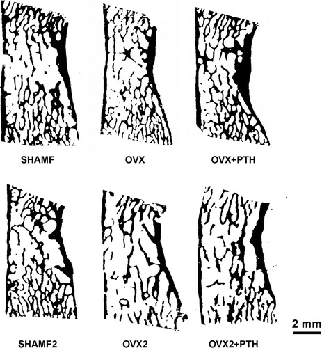 Figure 2.  Examples of 1 bit black/white threshold images used for bone histomorphometry. Original digital images were obtained from 2.5 μm-thick sections of lumbar vertebra (L4) stained with von Kossa by using an optical scanner at 9600pp resolution (pixel size = 2.6 μm).