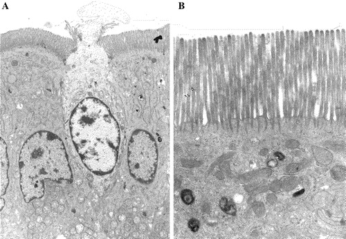 Figure 1.  Epithelial cells with an apical brush border. (A) Tall, columnar small intestinal enterocytes with a brush border facing the lumen of the gut. The apoptotoic cell in the middle is in the process of being extruded from the epithelium. (B) A closer view of the apical region of an enterocyte showing a dense array of microvilli with rootlets of actin filaments extending into the underlying cytoplasm. Notice that organelles such as mitochondria, lysosomes and endosomes are excluded from this uppermost terminal web region of the cytoplasm.