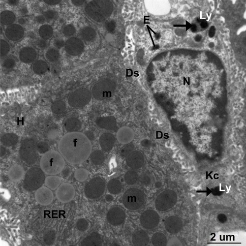 Figure 18 Transmission electron micrograph of a hepatic cell from the treated group containing numerous fat globules, rough endoplasmic reticulum, and mitochondria. Note Kupffer cells containing numerous endosomes and lysosomes filled with electron-dense material of silver nanoparticles (arrows) and the fragmented microvilli in Disse’s space could be seen between the hepatic cell and Kupffer cell. Scale bar 2 μm.Abbreviations: Ds, Disse’s space; E, endosomes; f, fat globules; H, hepatocyte; Kc, Kupffer cells; Ly, lysosomes; m, mitochondria; N, nucleus; RER, rough endoplasmic reticulum.