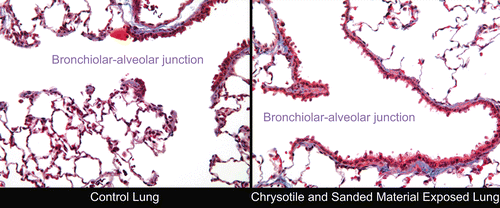 Figure 10.  Histopathological photomicrographs: on the left is a control lung at 28 days following cessation of exposure. On the right is a lung from the chrysotile fibers and sanded joint compound particles group at 90 days following cessation of exposure. In the upper right-hand corner is a terminal bronchiole leading through the bronchiolar alveolar junction into the alveoli. A few macrophages can be seen in some of the alveoli (magnification 40×).