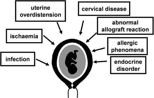 Figure 2. Pathological processes implicated in the preterm parturition syndrome. Reproduced with permission from reference 2.