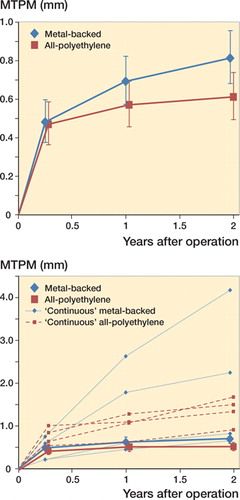 Figure 2. RSA analysis results of maximum total point motion (MTPM). Top: mean and 95% confidence interval for the groups; bottom: mean and 95% confidence interval for the same groups excluding 8 individual components showing continuous migration of >0.2 mm in the second postoperative year. These individual components are illustrated as 4 dashed blue lines (metal-backed) and 4 dashed red lines (all-polyethylene).
