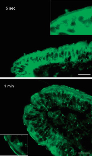 Figure 3. Rapid insertion of BODIPY fatty acids into the brush border. Fluorescent images of short-term labeled explants. Labeling of the enterocyte cytoplasm and brush border was evident after only few seconds of exposure to the analog. The fluorescence frequently appeared patch or punctate. Bars, 20 μm.