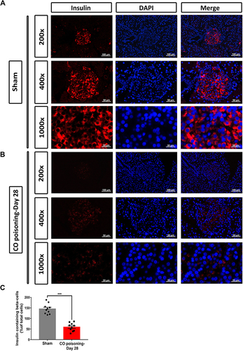 Figure 4 Insulin expression by immunofluorescence staining. Pancreatic islet was labeled by insulin antibody co-staining with nucleus staining (DAPI) shown in different magnification (200×–400×) in the sham (A) and CO poisoning group (B). Comparison of the number of insulin-positive cells per field was showed in the (C) ***p < 0.001.