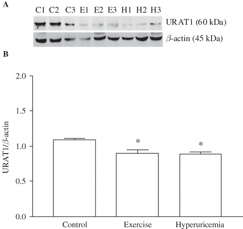 FIGURE 3. Effect of heavy muscle activity on the protein levels of URAT1 in renal cortex from Wistar rats. Total protein (50 μg) was gathered from kidney cortex. Western blot against URAT1 and β-actin was performed as described in Materials and Methods. (A) Western blot against URAT1 and β-actin. Antibody against URAT1 recognized a band in the range of 60 kDa, and the anti-β-actin antibody recognized a band at 45 kDa. (B) Effect of heavy muscle activity on the expression of URAT1. Amount of URAT1 western blot signal was normalized to the respective signal from β-actin. Data are mean ± SEM of measurements in five independent experiments each group. *p < 0.001 Statistical differences from control animals.
