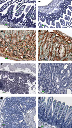 Figure 6. Immunohistochemical staining for CD8, Mac-1, cleaved caspase-3, and Ki-67 expressing cells in the small intestinal tissue from representative animals; control animal (left) and treatment animal (right). (A) higher abundance of positive CD8 cells in control group animal; magnification 40× (B) localization of CD8 cells within and around a tumorous overgrowth; magnification 40× (C) expression of Mac-1 cells in a control group animal; magnification 40× (D) scarce positive Mac-1 cells detected in treatment group animal; magnification 40× (E) staining for cleaved caspase-3: high expression of apoptotic cells in the area of the tumor with greater concentration found at the surface; magnification 20× (F) lower expression of cleaved caspase-3 cells in normal mucosa; magnification 40× (G) proliferation cells marker Ki-67 greatly present in adenoma of control group animal; magnification 20× (H) fewer Ki-67 positive cells seen within microvilli of the small intestine of the treatment group animal, see pointing arrows; magnification 20×.