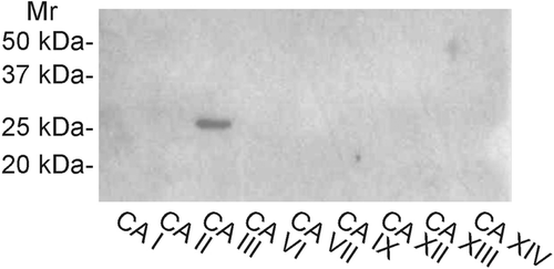 Figure 1.  Western blot of recombinant human CA III identified with the new anti-CA III antibody. The antibody identifies a single 30-kDa polypeptide band. No reactions are seen with the other isozymes.