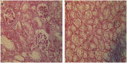 Figure 4. Photomicrographs of group GTin (Gentamicin + T. indica extract treated): (A) renal cortex presenting normal glomeruli with no evidence of necrosis, but small number of vacuoles in the proximal tubular cells and (B) renal medulla presenting normal tubules with no presence of hyaline and granular casts.