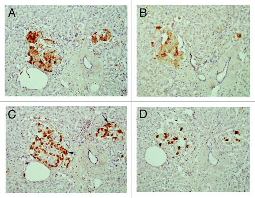 Figure 2. Disbetic islets, Case 1. β cells and α-cells (arrow) were about equal in number in large islet (Left), and α-cells were slightly more in medium-sized islet (Right). β cells were moderately to strongly immunopositive with plump cytoplasm whereas α-cells (arrows) and δ-cells were slightly smaller in the cytoplasm and were strongly immunostained. IAPP-positive cells were about ¼ that of β-cells in large islet, but medium-sized islet had only a few positive cells. (A) Insulin; (B) IAPP; (C) Glucagon; (D) SRIF immunostained; Original magnification X 470.