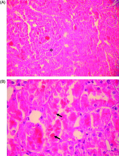 Figure 4. (A) Kidney of rat administered colistin in doses of 450,000 IU/kg/day showing acute tubular necrosis with glomerular preservation (*) (HE × 200). (B) Kidney of rat administered colistin in doses of 450,000 IU/kg/day showing acute cortical necrosis with numerous tubular casts (↗) (HE × 400).