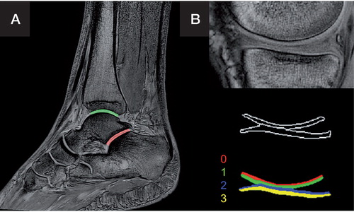 Figure 2. Segmentation of the upper (green) and lower (red) ankle joint (articulatio subtalaris) with a distal and a proximal segment each (panel A), and the knee joint (segments 0–3) (panel B).