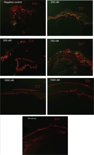 Figure 7 Immunofluorescence analysis of GFAP and α-SMA at 4 weeks after siRNA-PKCα injection.Notes: There are faint expressions of GFAP (red) and (green) in normal retinas; these expressions seemed more pronounced in the epiretinal membranes in the negative control, as well as in the 250 nM, 500 nM, and 750 nM groups than in the 1000 nM and 1500 nM groups. Scale bar: 100 μm.Abbreviations: GFAP, glial fibrillary acidic protein; α-SMA, α-smooth muscle antibody; siRNA-PKCα, small interference RNA-protein kinase C-alpha.