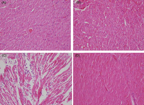 Figure 1. (A) Hematoxylin and eosin-stained sections (×400) of normal heart tissue (control). (B) Heart tissue of GSPE (100 mg/kg p.o.)-treated rats showing almost normal morphology. (C) Heart tissue of CsA-treated rats showing widespread myocardial edema, inflammation, disorganization, and mild fibrosis. (D) Heart tissue of GSPE (100 mg/kg p.o.) + CsA-treated rats showing prevention of CsA-induced alterations.