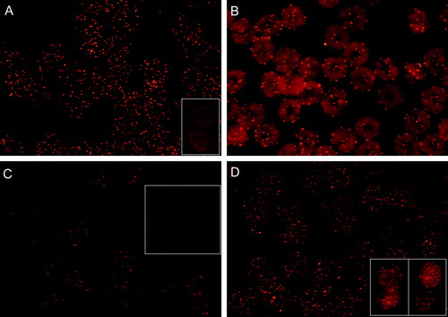 Figure 1.  Fluorescence micrographs showing (discoid) human erythrocytes treated with CTB plus anti-CTB. Erythrocytes post-fixed (60 min, RT) with either PFA (5%) or GA (1%) are shown in (A) and (B), respectively. (A inset); erythrocytes incubated with CTB only. Erythrocytes post- or pre-treated with methyl-β-cyclodextrin relative to CTB plus anti-CTB treatment are shown in (C) and (C inset), respectively. Cells were fixed with PFA (5%) and GA (0.01%). Erythrocytes fixed with PFA (5%) or PFA (5%) and GA (0.01%) prior to CTB plus anti-CTB treatment are shown in (D) and (D insets), respectively.