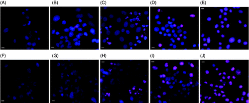 Figure 2. Hoechst/PI staining of MES-SA cells (upper panel) and Dx5 cells (lower panel) treated by incubator hyperthermia. Images were taken either immediately, or 24 h after the treatment. The scale bar represents 8 µm. (A) Control MES-SA; (B) MES-SA immediately after 1 h 43°C incubation; (C) MES-SA 24 h after 1 h 43°C incubation; (D) MES-SA immediately after 30 min 50°C incubation; (E) MES-SA 24 h after 30 min 50°C incubation; (F) control Dx5; (G) Dx5 immediately after 1 h 43°C incubation; (H) Dx5 24 h after 1 h 43°C incubation; (I) Dx5 immediately after 30 min 50°C incubation; (J) Dx5 24 h after 30 min 50°C incubation.