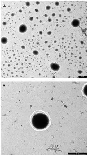 Figure 1 Transmission electron microscopy images of diflucortolone valerate–loaded nanoparticles at magnification ratio of 33,000× (A), at magnification ratio of 71,000× (B).