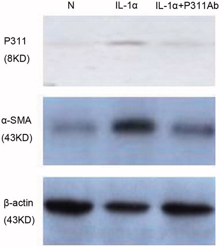 Figure 4. Western blot analyses of P311 and α-SMA protein in NRK52E cells. Cells were cultured in the presence of medium alone, IL-1α, or IL-1α plus a neutralizing anti-P311 antibody.