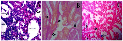 Figure 1. Histology represents kidney dysfunctions induced by Alloxan. (A) Which was stained by Hematoxylene and Eosin shows various inflammatory components infiltration, most of the glomerulas have been destroyed by diabetes, (B) which was stained using sirius red and picric acid shows collagen deposition (red parts), and (C) which was stained Prusian blue to determine the iron overload. Inside figures ic—inflammatory cells, fb—fibrosis, and ip—iron pigments. The histology was prepared in our lab.