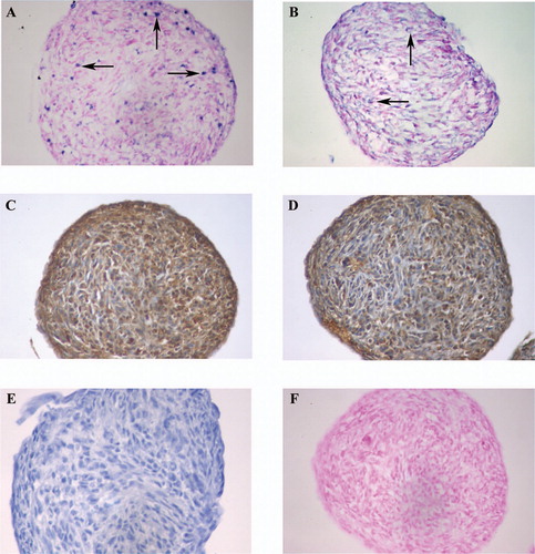 Figure 2. In situ hybridizations (ISH) of (A) uPA mRNA; (B) tPA mRNA; and (F) a sense, negative control for uPA mRNA, are made with Blue Map staining. (C) uPA immunostaining (IHC); (D) tPA IHC; and (E) CD‐68 IHC (negative control) are made with brown DAB staining. Time point was 72 h. Arrows show some positive signals of ISH. 40× objective was used in microscopy.