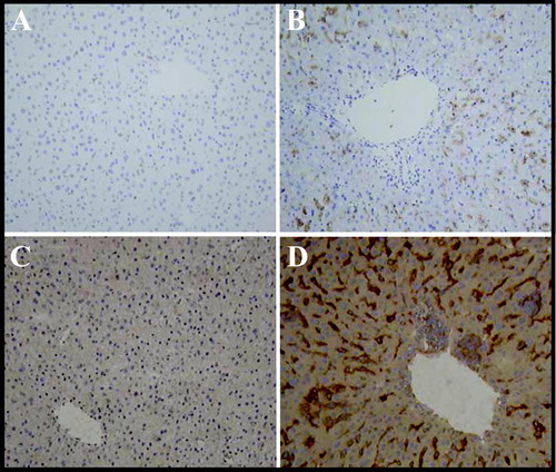 FIG. 3 Immunohistochemical Detection of Histocyte Cell Markers Lysozyme and CD 115. Female mice were administered 4 mg/kg ISIS 12449 as a single dose (S) for 1 wk. Liver was frozen in OCT and sections were incubated with the primary antibodies lysozyme (Panel A,B) or CD115 (Panel C,D) and then with a HRP-labeled secondary antibody. Peroxidase specific staining is indicated by the dark brown staining. The panels are representative photomicrographs of each treatment group: A, C, PBS; B, D ISIS 12449S.