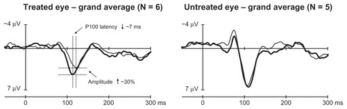 Figure 3 Grand average waveforms of individual waveforms from Figure 2.