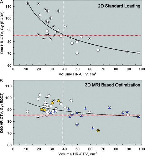Figure 5.  D90 as a function of HR CTV volume comparing standard 2D and optimized 3D treatment plans in a consecutive series of 50 locally advanced cervix cancer patients treated at Aarhus University with tandem and ring intracavitary brachytherapy plus additional interstitial needles in selected cases. The horizontal red dotted line indicates the desired D90 of 85 Gy for HR CTV. The vertical white dotted line indicatse the mean volume of HR CTV. A: Standard library plans (2D). The 18 dotted data points (z) indicate cases in which the dose volume constraints for organs at risk were superseded. B: Optimized (3D) plans. Additional interstitial needles were applied in 15 cases (blue triangle), and a vaginal cylinder in 4 cases (yellow circle). The 4 dotted data points (z) indicate cases in which the dose volume constraints for organs at risk where superseded.