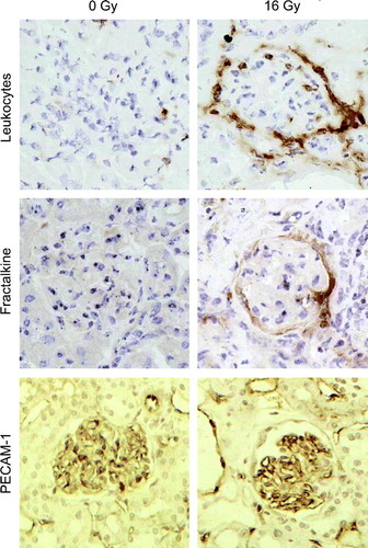 Figure 2.  Photographs of mouse kidney sections stained immunohistochemically for leukocytes (A–B), fractalkine (C–D) and PECAM-1 (E–F) at 40 weeks after irradiation with 0 Gy or 16 Gy. All photomicrographs were taken at an original magnification of 400×. Sections were counterstained with hematoxylin and eosin.